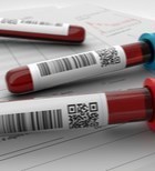 בדיקות דם תקופתיות